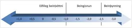 Beingisnunbeinmassibeinthinning
